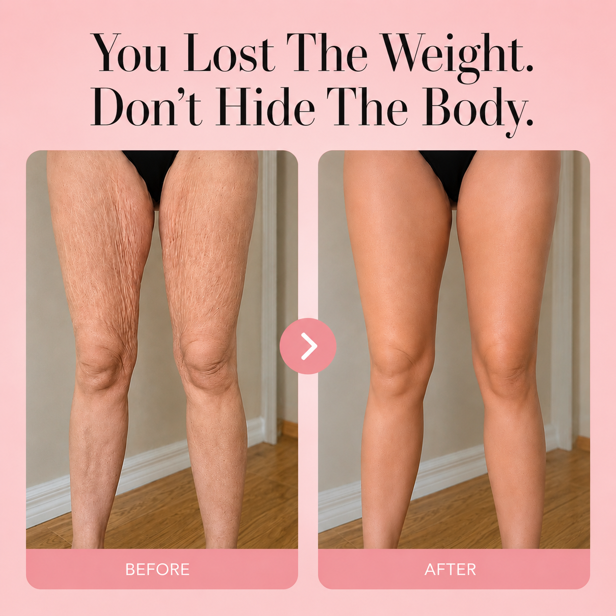 Lureva Body Perfecter